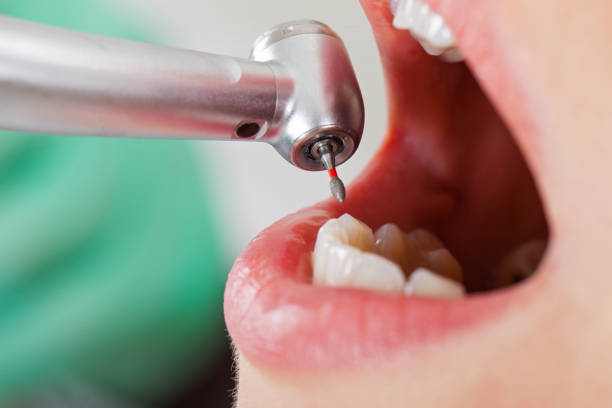 Best Emergency Dental Extractions in Madison, WV